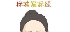 发际线种植会不会有后遗症?如何护理能尽量避免? 发际线种植会不会有后遗症?如何护理能尽量避免?