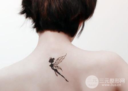 激光洗纹身