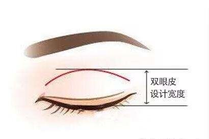 双眼皮