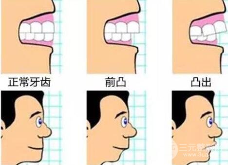 牙齿矫正技术