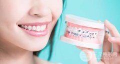 龅牙矫正会变好看吗，什么样的龅牙矫正会变好看?