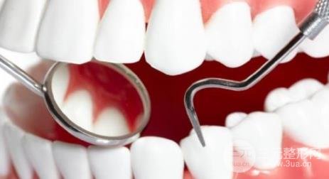 烤瓷牙缺点