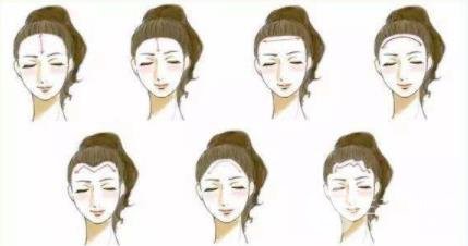 合肥植发