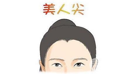 美人尖种植