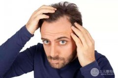 发际线种植会不会有后遗症？护理好了能尽量避免？