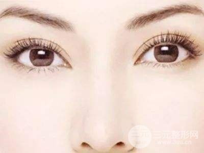 广州曙光整形医院双眼皮手术
