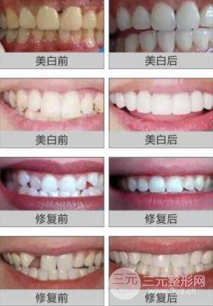 长沙美莱整形
