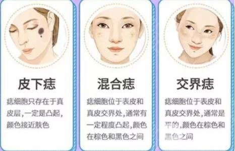 苏州薇琳整形