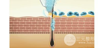 保定蓝山整形