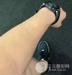 施尔美脱毛