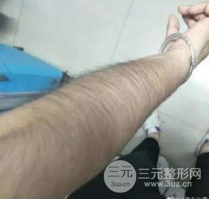 施尔美脱毛