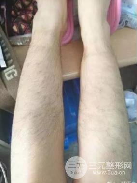 施尔美脱毛