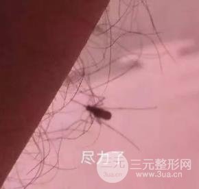 施尔美脱毛