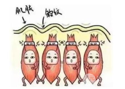有鱼尾纹怎么办?小鱼讲讲消除方法和注意点 有鱼尾纹怎么办?小鱼讲讲消除方法和注意点