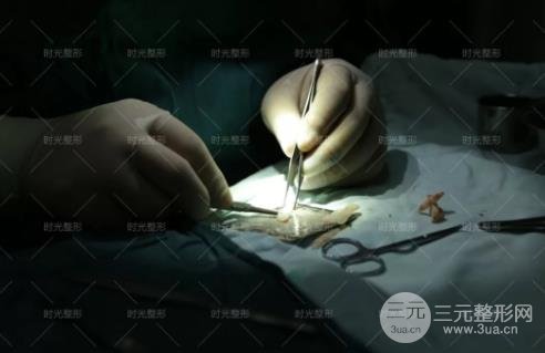 鼻整形