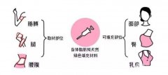 自体脂肪填充的价格大揭底牌 免花冤枉钱 自体脂肪填充的价格大揭底牌 免花冤枉钱