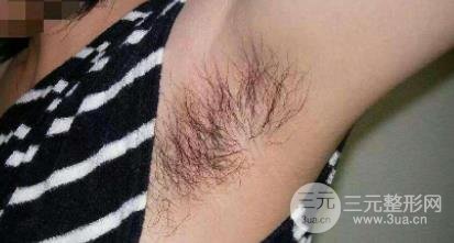 深圳脱毛价格