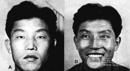 眼睛一单一双