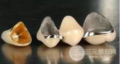 镍铬合金烤瓷牙的优缺点大揭秘，理想状态能用多久？