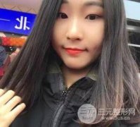 微创全切双眼皮费用详细解说 附33天日记参考