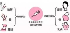 北京京韩做脂肪移植好不好,脸部填充会导致脸变大? 北京京韩做脂肪移植好不好,脸部填充会导致脸变大?