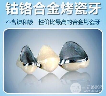 镍铬烤瓷牙,钴铬烤瓷牙