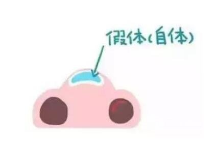 骨膜下隆鼻整形手术怎么做的？哪种情况适合做？