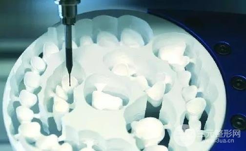 成都全瓷牙材料差别