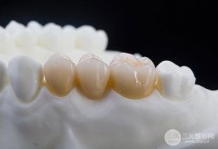 全瓷牙多少钱一颗 科普一波 爱美必备~，