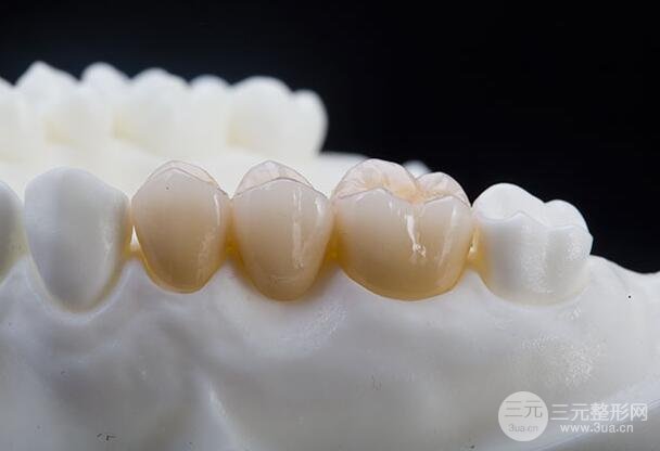 全瓷牙