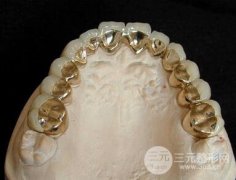 钯金烤瓷牙好不好 “假牙大全”总有款假牙适合您