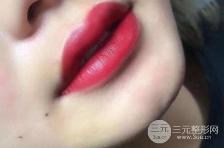 纹唇经历分享