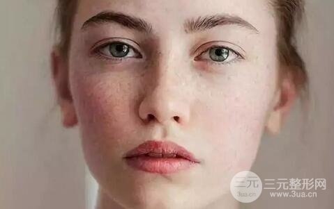 脸部美白祛斑