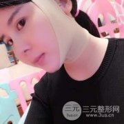 脸部吸脂减肥立变“V” 大伙儿在也不用担心“照骗”了