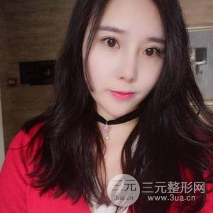脸部吸脂减肥
