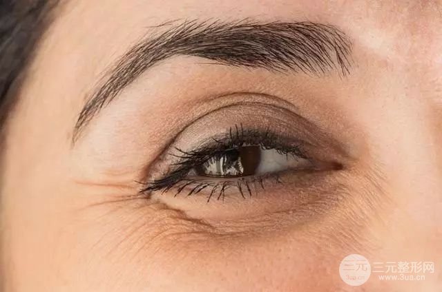 去除鱼尾纹方法有哪些