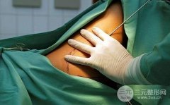 大腿吸脂减肥整形手术价格，可能有什么风险?