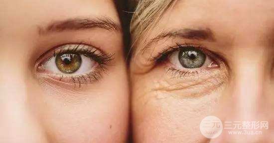 玻尿酸填泪沟可以维持多久?