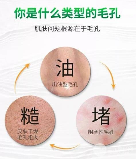 脸部毛孔收缩小窍门