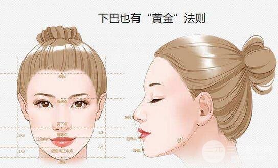 垫下巴多少钱