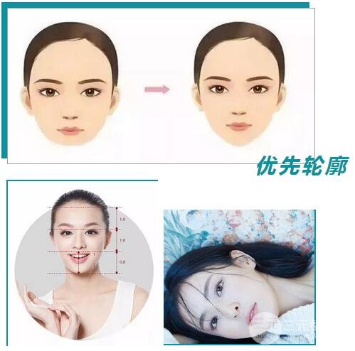 脸部整形价格