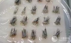 发际线整形价格,欢迎来到不整容换脸的世界~ 发际线整形价格,欢迎来到不整容换脸的世界~