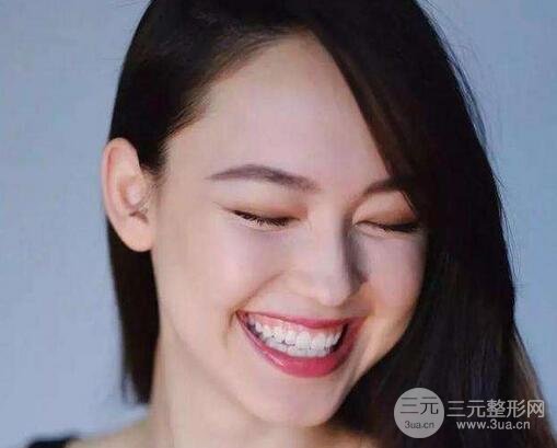 镭射激光美容