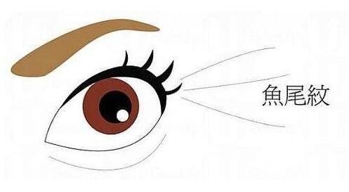 鱼尾纹多