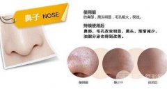 去黑头缩毛孔用什么方法好 科普一分钟秒变“水砰砰”
