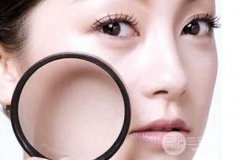 改良毛孔粗大小技巧一应俱全 都不容错过