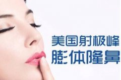 射极峰膨体价格多少钱 到底有神马优势 射极峰膨体价格多少钱 到底有神马优势