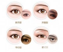 割双眼皮好吗 堪比整容 华丽蜕变美翻了