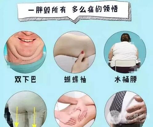 吸脂塑身