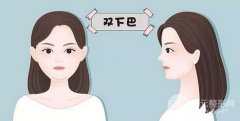 双下巴是怎么形成的 该如何消除呢